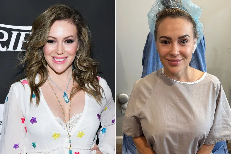 Alyssa Milano’s Bold Breast Implant Removal: Liberation, Legacy, and the Beauty Narrative
